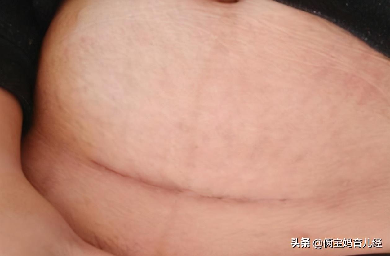 总是排气怎么回事？别尴尬，这是身体在跟你说话