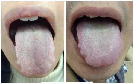 如何从舌头看健康/如何从舌头看身体健康